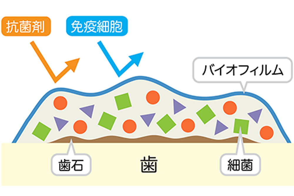 洗足池(大田区南千束)の歯医者、千葉歯科医院で予防歯科