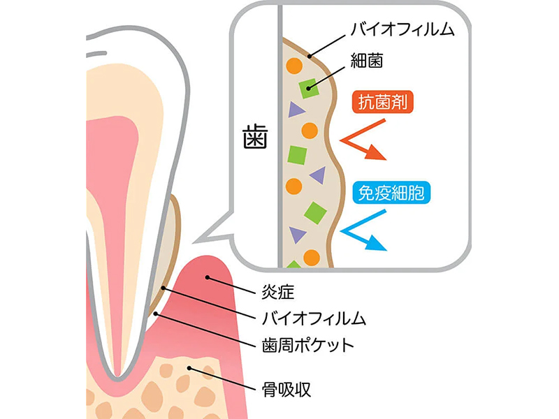 洗足池(大田区南千束)の歯医者、千葉歯科医院で予防歯科