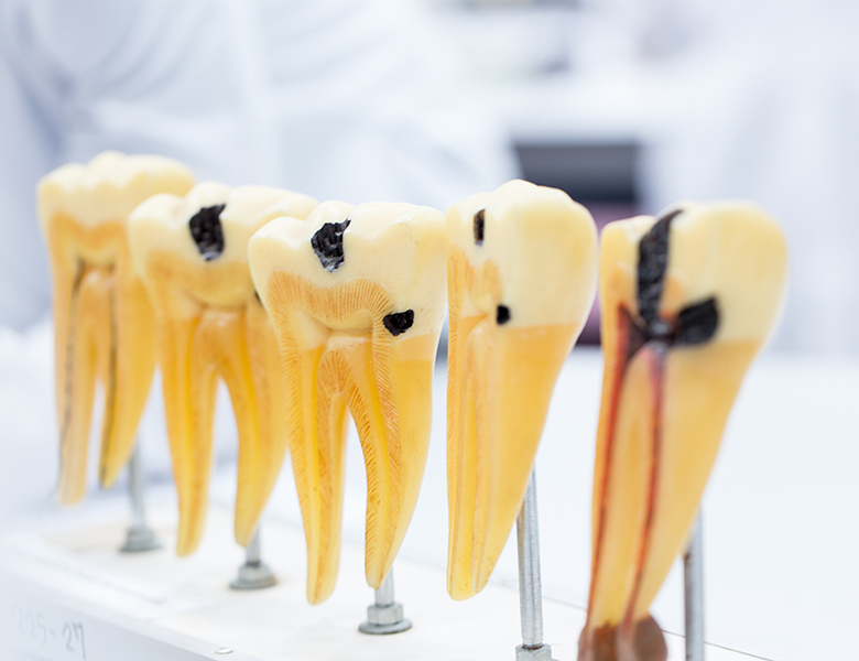 ⚠裁断済　歯周治療失敗回避のためのポイント33 : なぜ歯周炎が進行するのか、… ⚠裁断済 歯周治療失敗回避のためのポイント33 : なぜ歯周