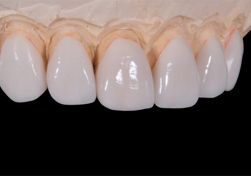 審美歯科治療 - 洗足池（大田区南千束）の歯医者｜千葉歯科医院